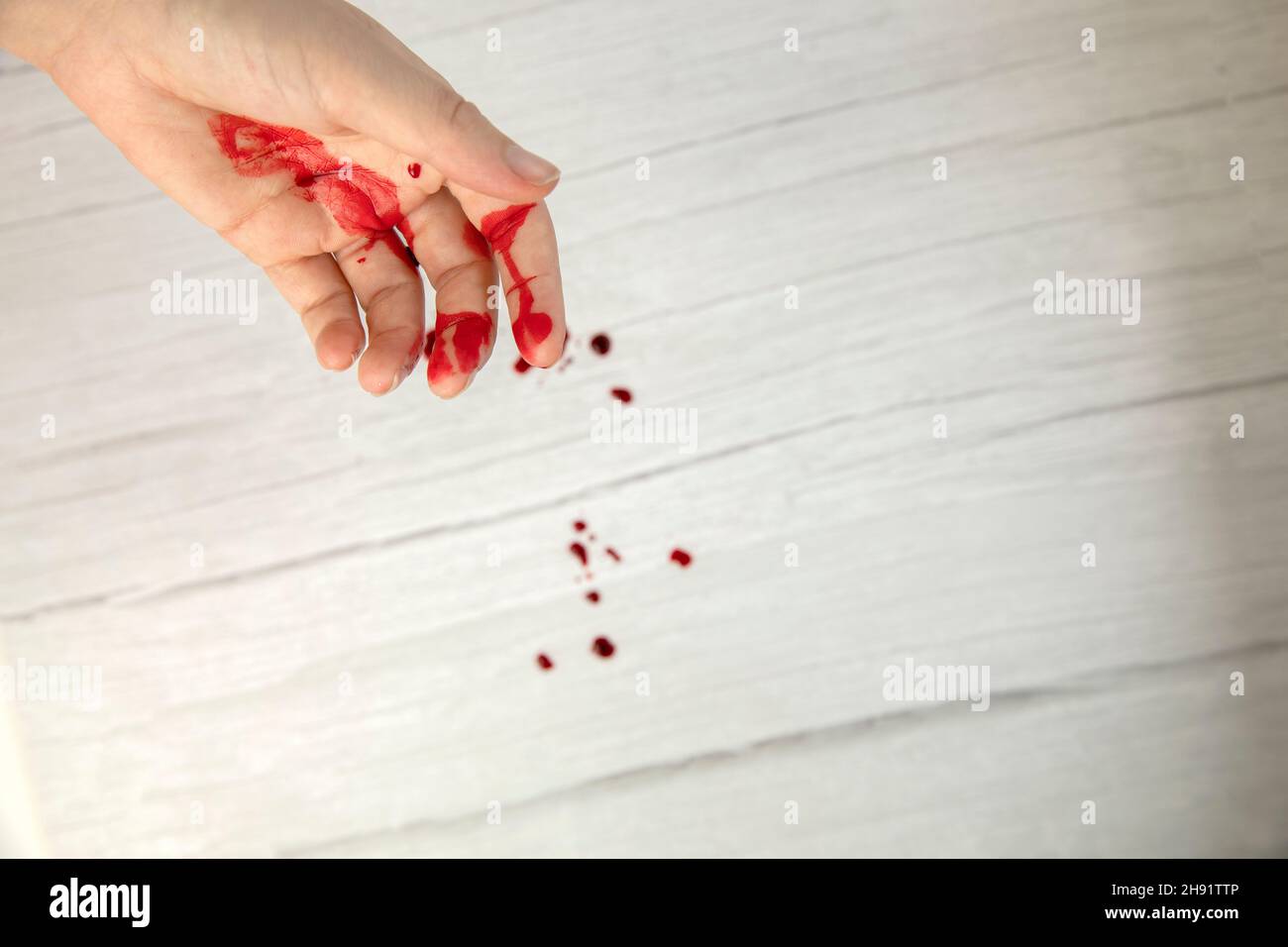 lesione della mano con sangue, ferita del sangue tagliata vista dall'alto, spazio di copia, concetto medico necessita di punti Foto Stock