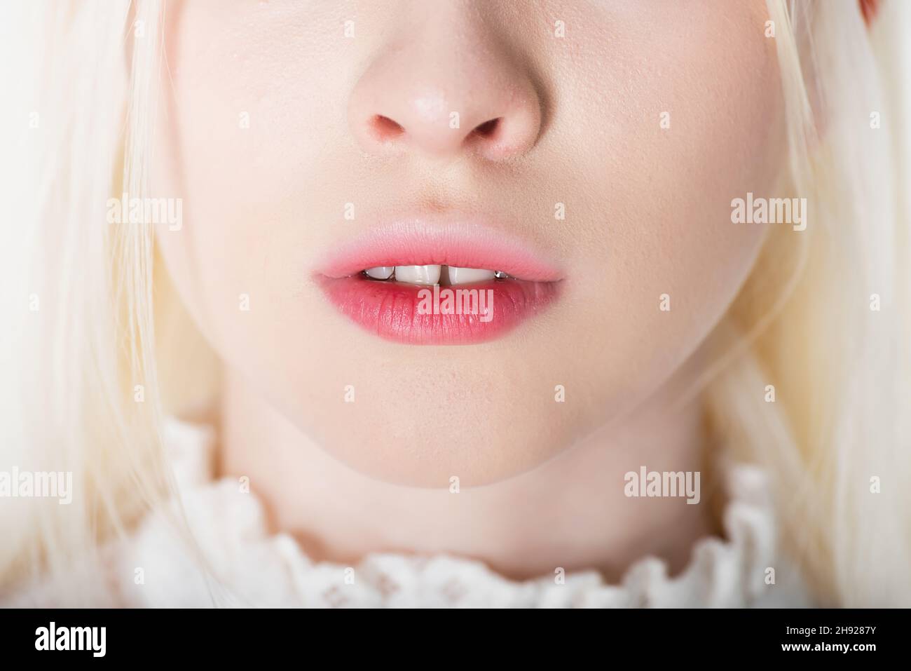 Vista croppata di albino bionda donna isolato su bianco Foto Stock