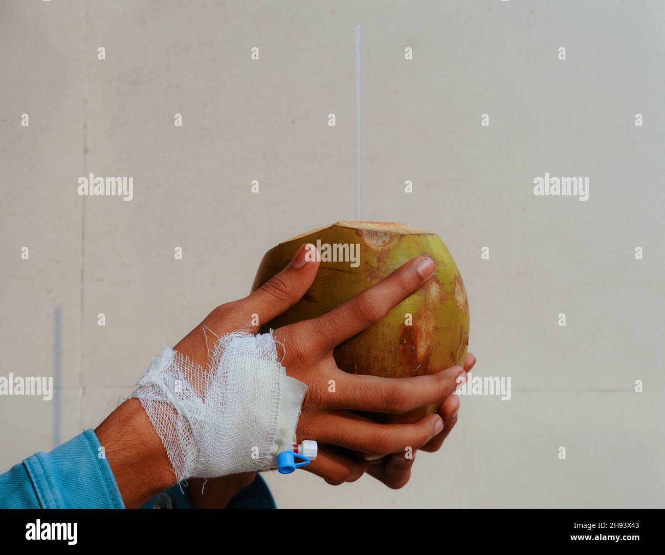 dengue trattamento cibo acqua di cocco in una mano paziente Foto Stock