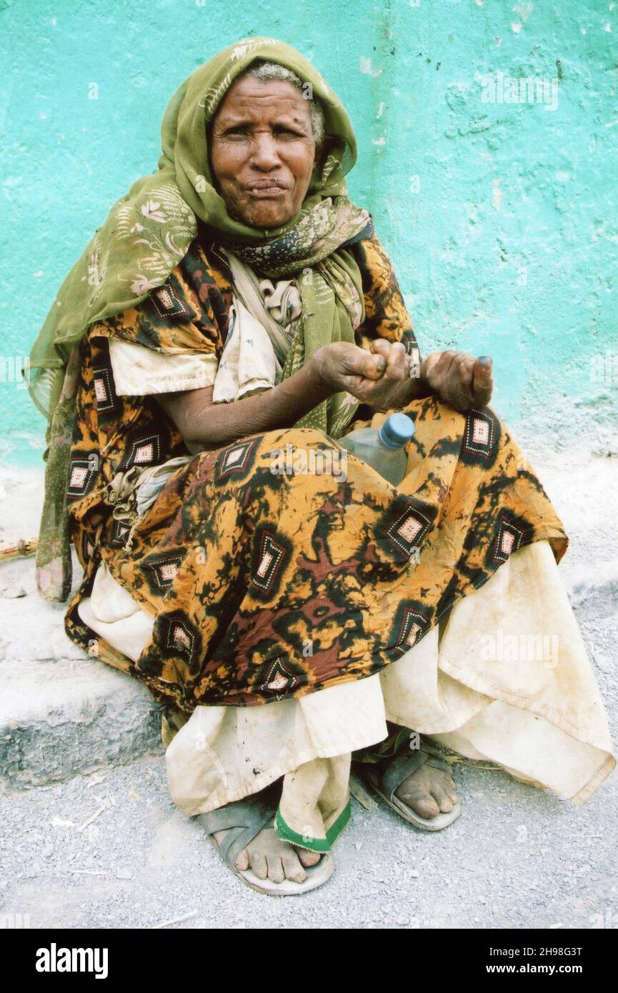 Donna che soffre di Leprosy implora elemosina ad Harar, Etiopia Foto Stock
