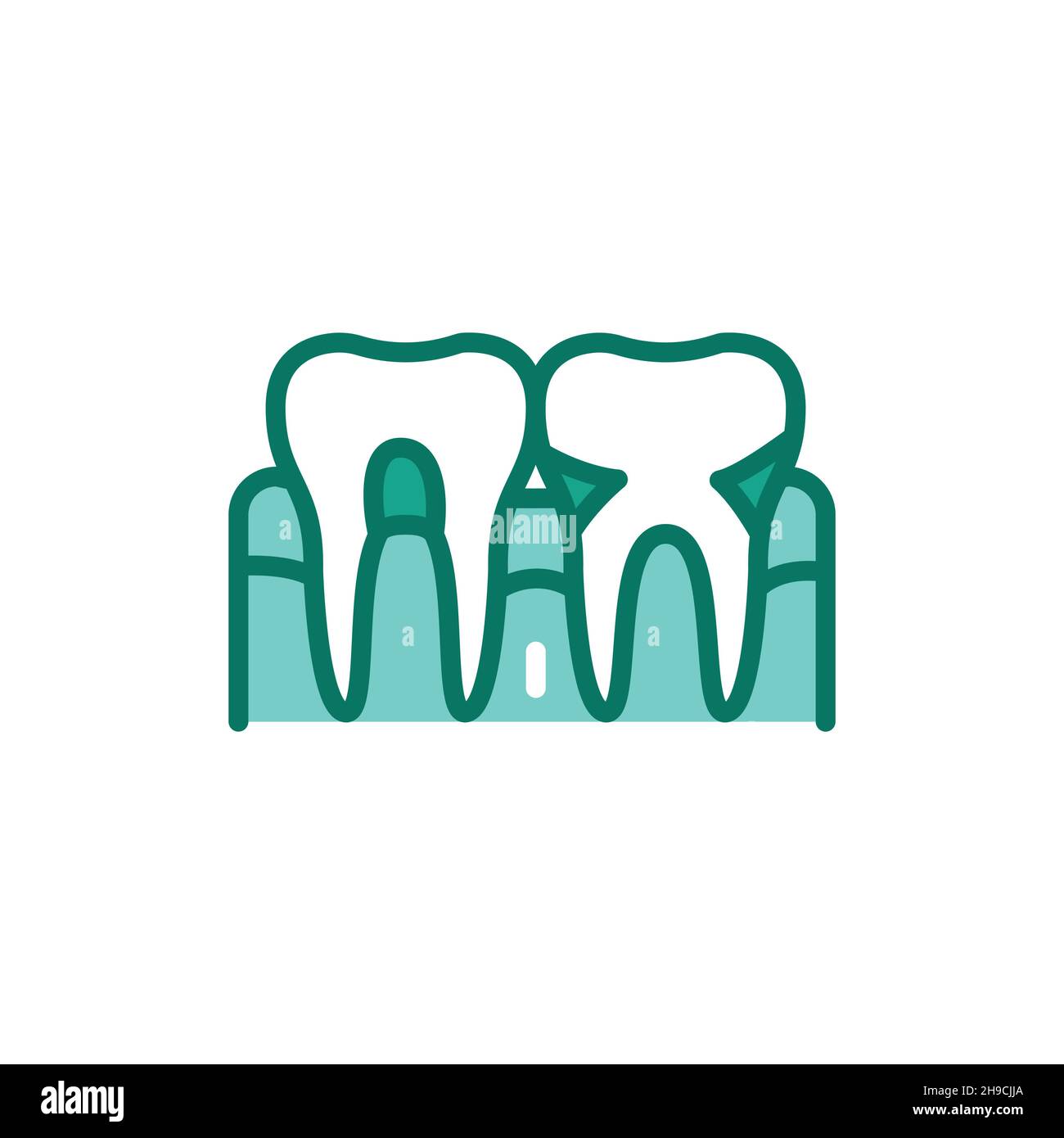 Icona della linea di colore della malattia parodontale. Elemento vettoriale isolato. Pittogramma per pagina web, app mobile, promo Illustrazione Vettoriale