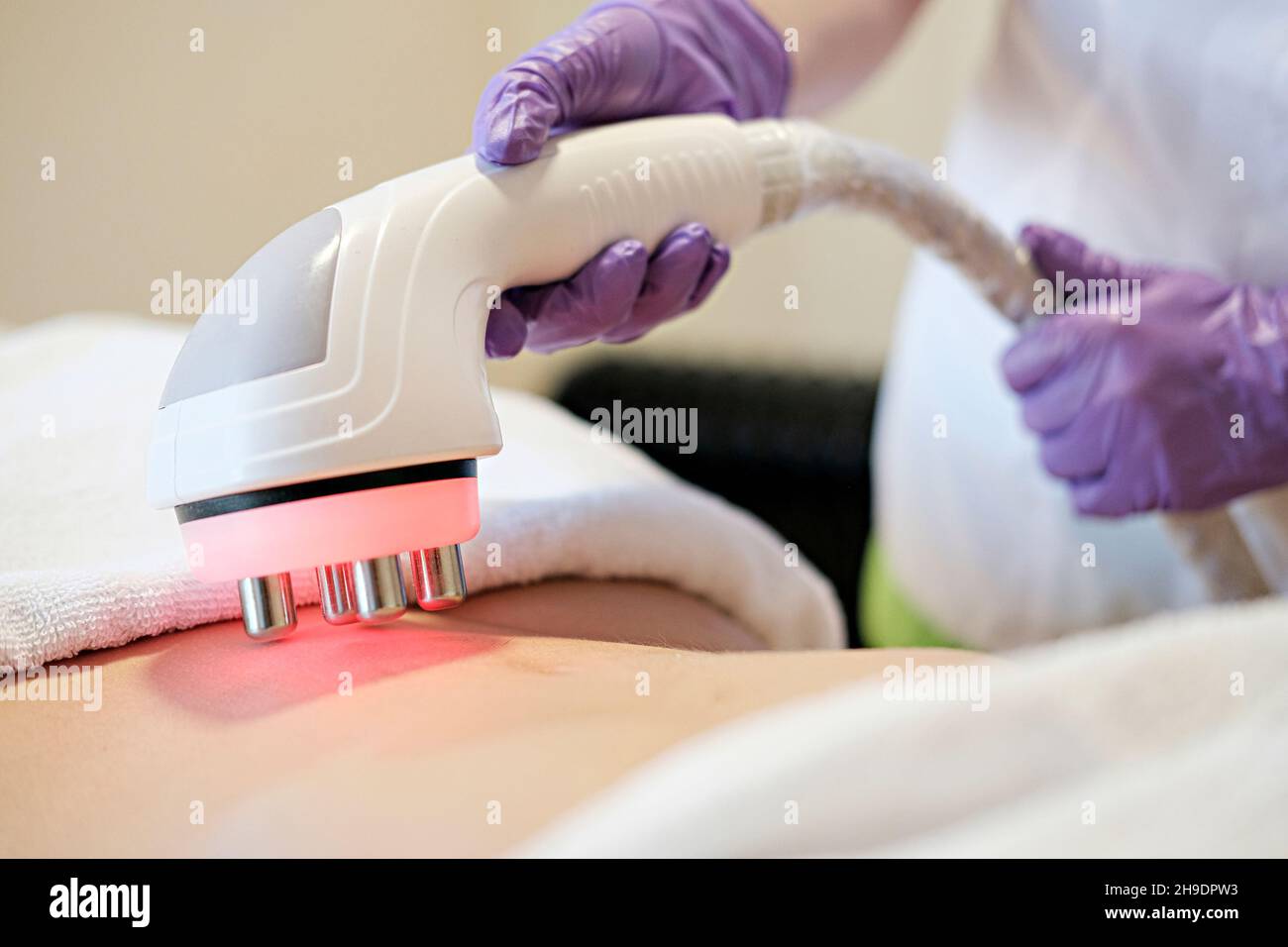 Cosmetologia hardware. Immagine concettuale delle natiche femminili ottenendo la procedura di sollevamento rf in un salone di bellezza. Primo piano Foto Stock