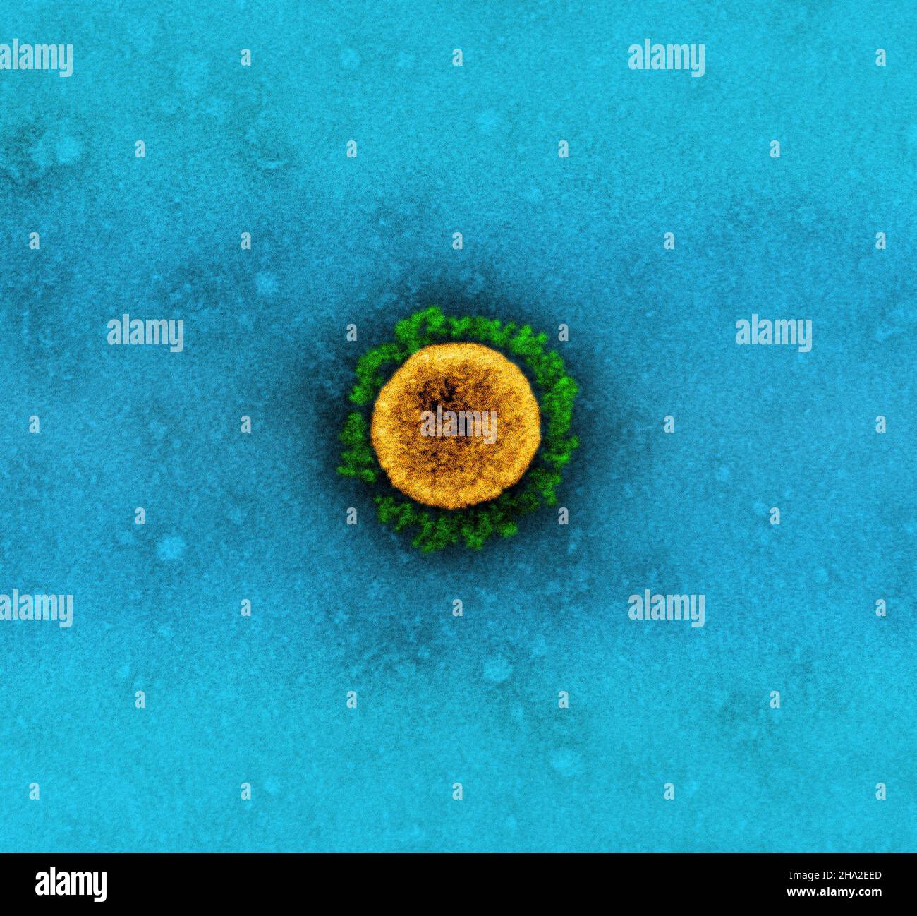 Micrografia elettronica a trasmissione di una particella di virus SARS-COV-2 (variante UK B.1.1.7), isolata da un campione di paziente e coltivata in coltura cellulare. T Foto Stock