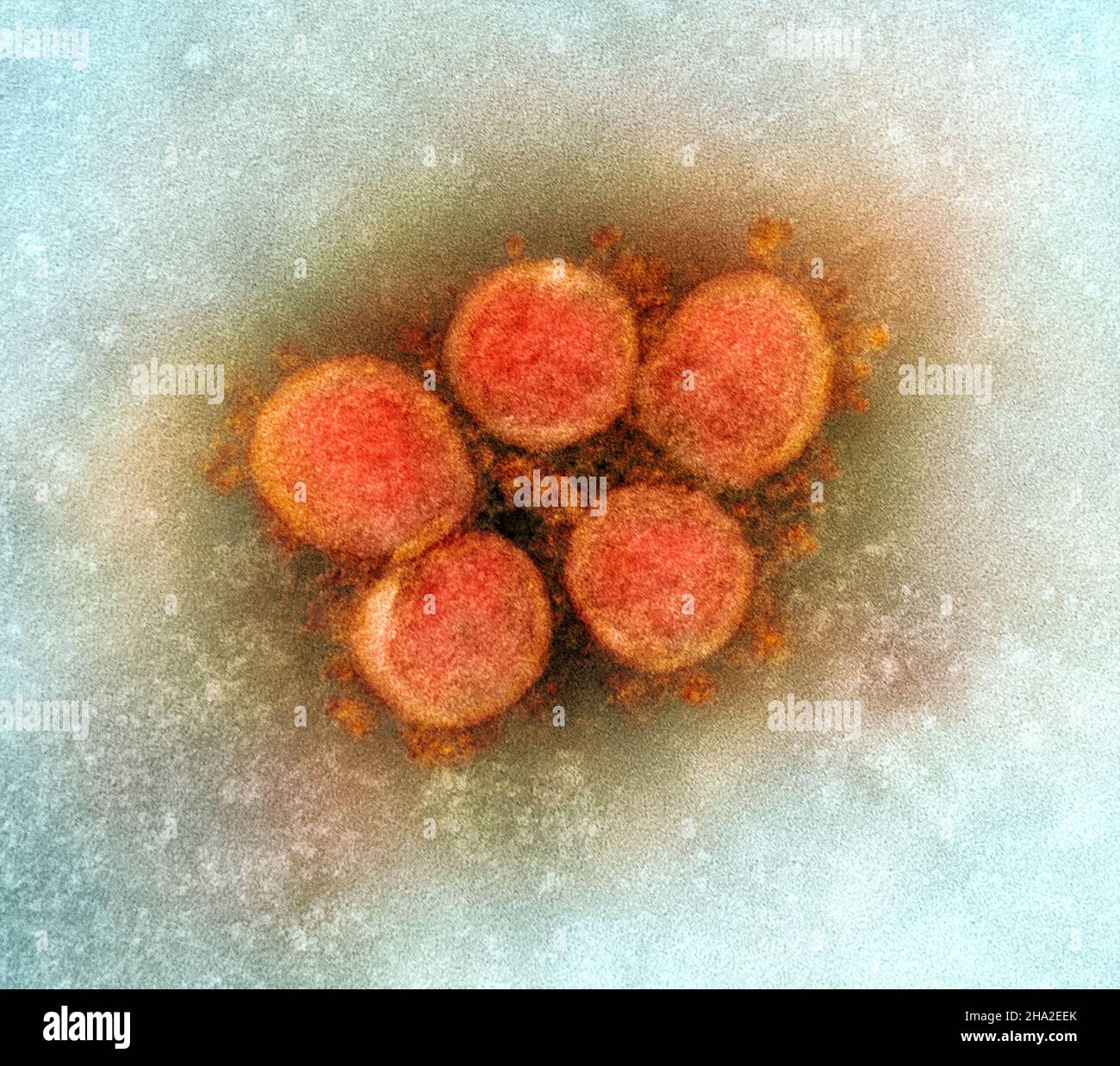 Nuovo coronavirus sars-COV-2 Foto Stock