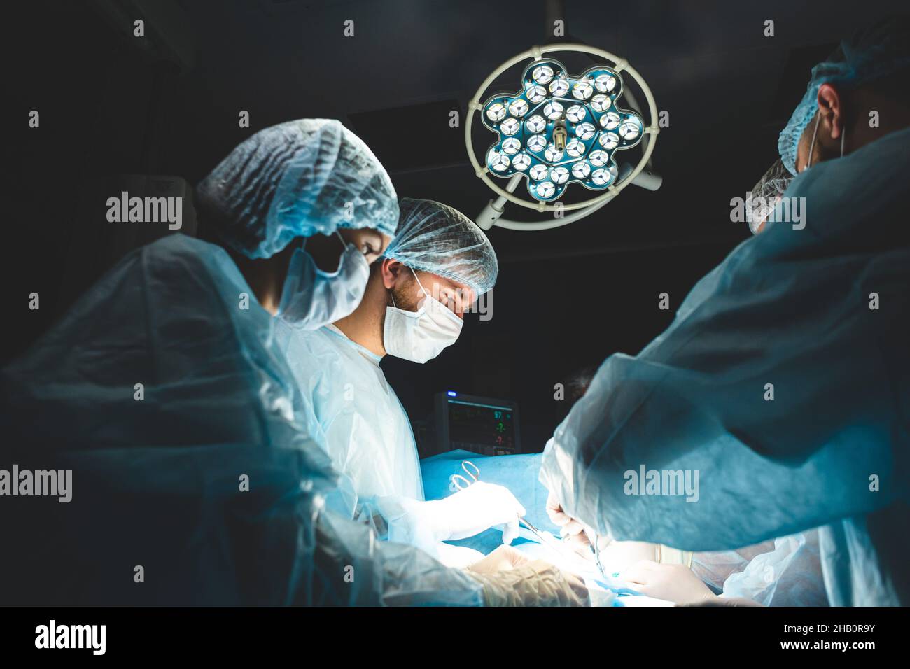 Un team professionale internazionale di chirurgo, assistenti e anestesista esegue un'operazione complessa su un paziente sottoposto ad anestesia generale. Scuro Foto Stock