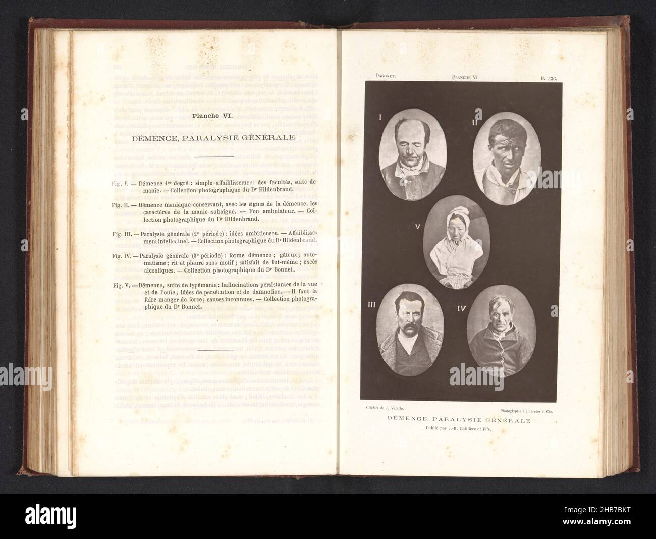 Cinque ritratti di persone che credevano di soffrire di demenza, Démence, Paralysie Générale (titolo sull'oggetto), J. Valette (menzionato sull'oggetto), Lemercier & Cie (menzionato sull'oggetto), c.. 1866 - pollici o prima del 1876, carta, altezza 165 mm x larghezza 102 mm Foto Stock