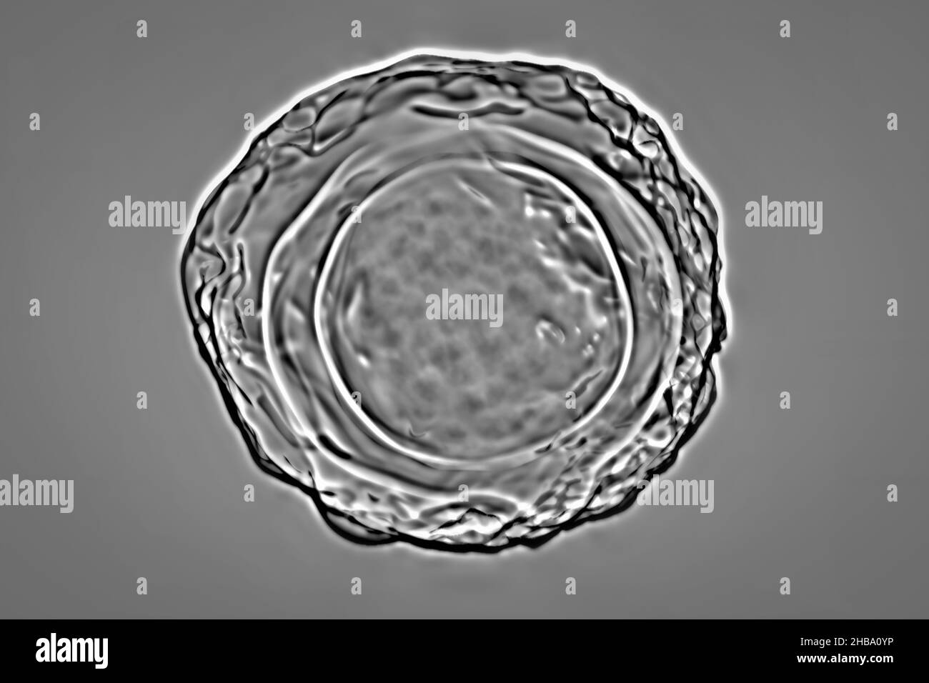 Uova fecondate di Ascaris lumbricoides, illustrazione. Le uova hanno un involucro protettivo spesso, queste uova sgranate possono sopravvivere sfavorevoli condizioni di siccità, sepolto nel suolo. Il verme adulto (fino a 35cm) è un parassita intestinale degli esseri umani. L'infestazione può causare dolore addominale, vomito, costipazione, malnutrizione e anemia. La verme femminile depone un gran numero di uova nell'intestino umano che vengono escrete nelle feci e ingerite da un nuovo ospite attraverso acqua o cibo contaminati. Questa infezione è nota come ascariasi. Foto Stock