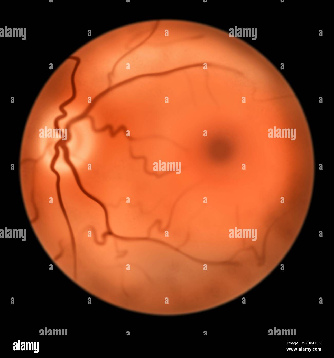 Illustrazione della retina oculare sana che mostra disco ottico, vasi sanguigni, macula, e fovea. Foto Stock