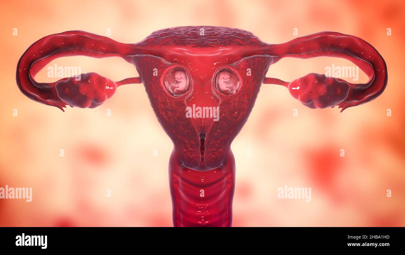 Gravidanza multipla, illustrazione. Gemelli dizigoti che si sviluppano nell'utero separatamente alla settimana 8. Foto Stock