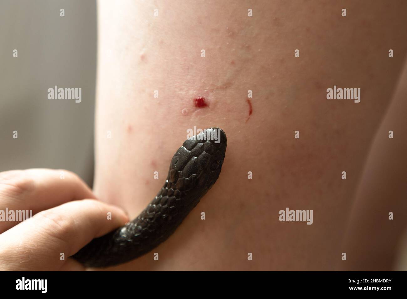 Serpente velenoso morso nella gamba dell'uomo, primo piano. Foto Stock