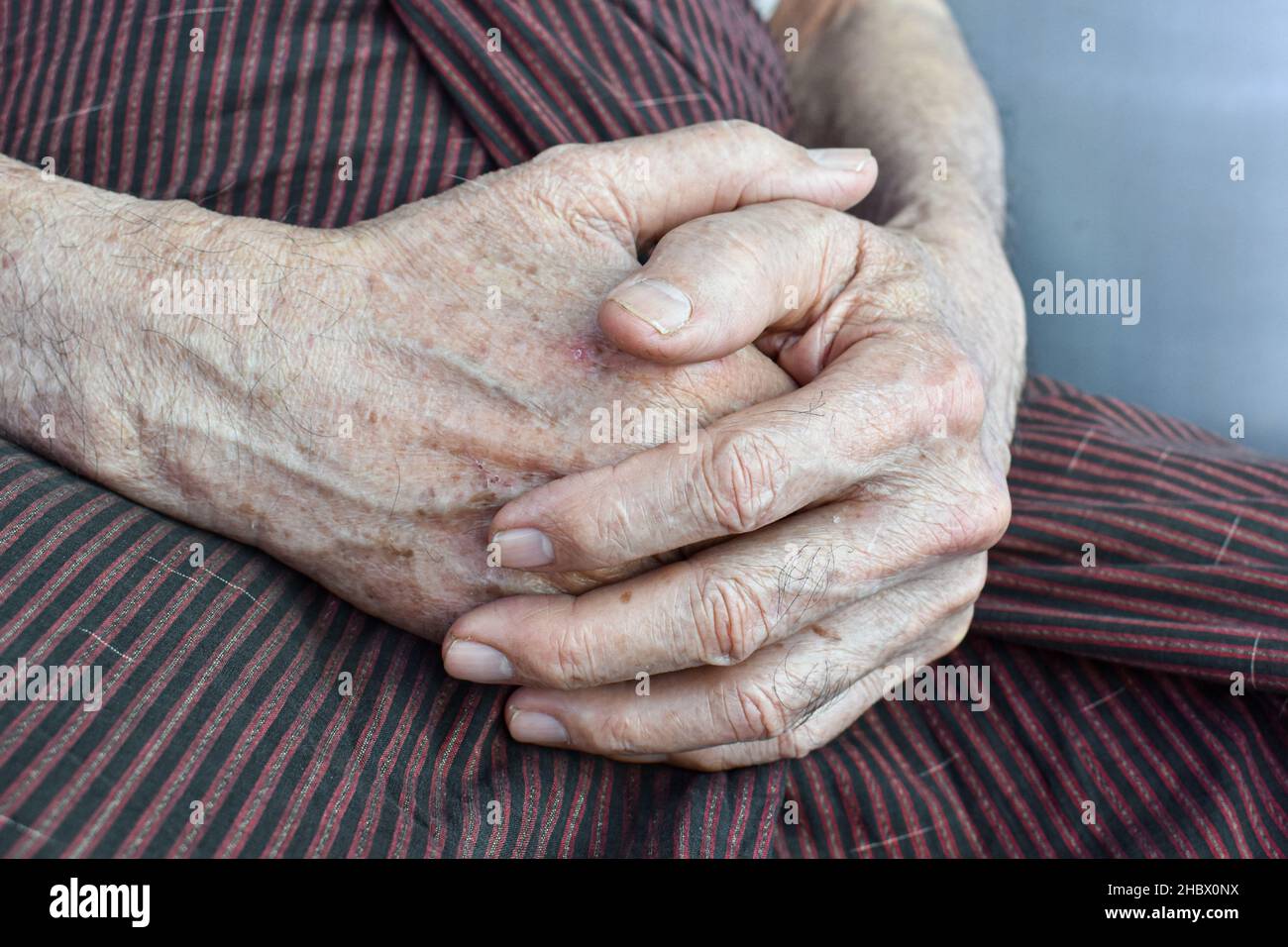 Mani aggrappate di Myanmar asiatico o anziano birmano. Concetto di artrite reumatoide, osteoartrite o dolore articolare. Foto Stock