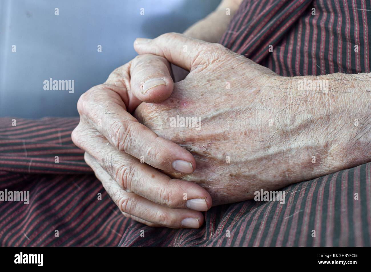 Mani aggrappate di Myanmar asiatico o anziano birmano. Concetto di artrite reumatoide, osteoartrite o dolore articolare. Foto Stock