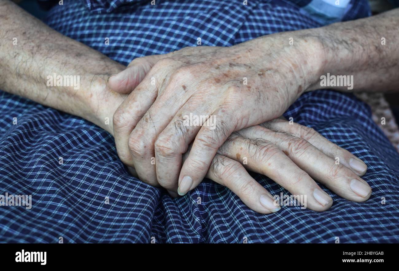 Macchie di età sulle mani dell'uomo anziano asiatico. Sono macchie marroni,  grigie o nere e anche chiamati macchie di fegato, lentigine senili,  lentigine solari, o macchia di sole Foto stock - Alamy