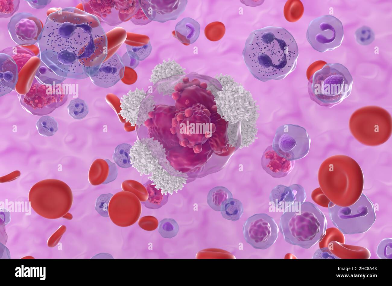 Le cellule T attaccano la leucemia linfoblastica acuta (TUTTE) le cellule tumorali nel flusso sanguigno - primo piano vista 3D illustrazione Foto Stock