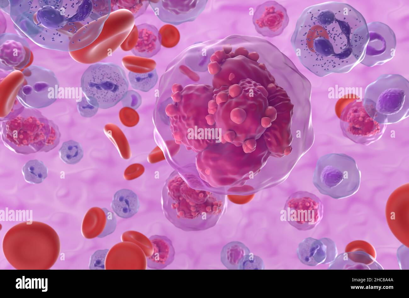 Leucemia linfoblastica acuta (TUTTE) cellule tumorali nel flusso sanguigno - primo piano vista 3D illustrazione Foto Stock