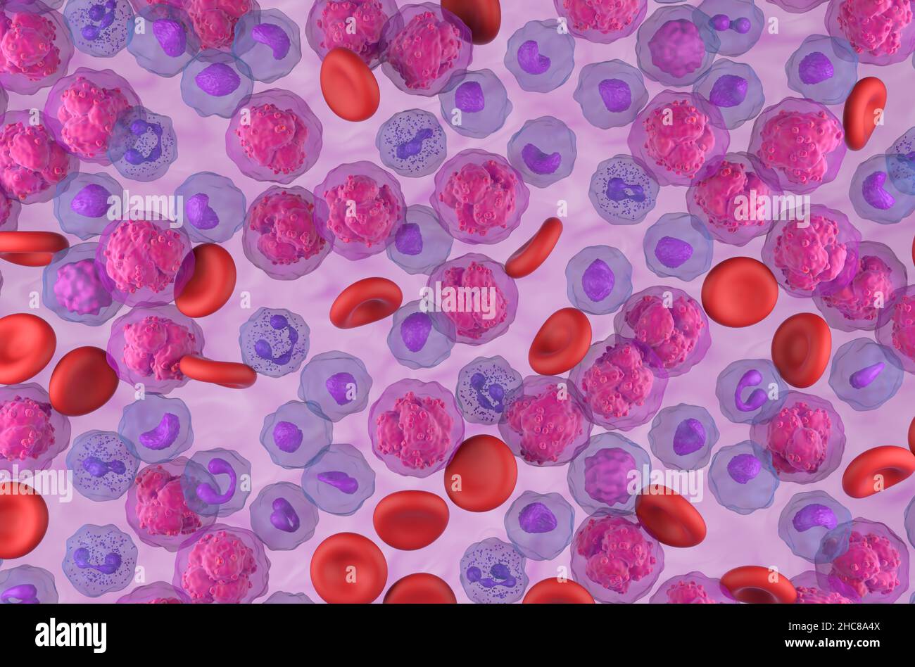 Leucemia linfoblastica acuta (TUTTE) cellule tumorali nel flusso sanguigno - vista dall'alto illustrazione 3D Foto Stock