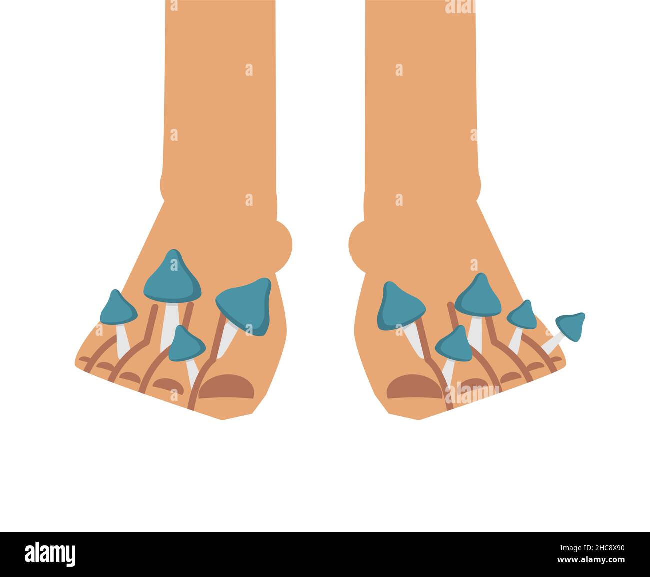 Fungo sui piedi. Micosi tra le dita. Malattia della pelle delle dita e dei piedi Illustrazione Vettoriale