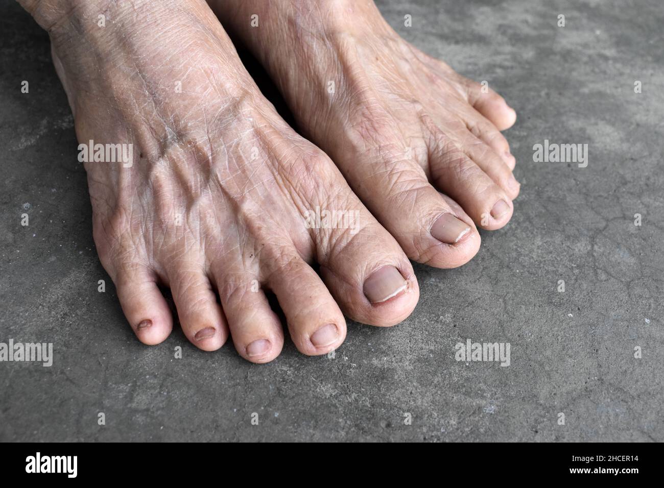 Piedi di donna anziana asiatica. Concetto di salute del piede e delle dita dei piedi, e pelle sottile. Isolato su sfondo concreto. Foto Stock