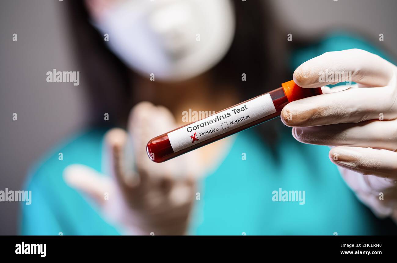 2019-nCoV Coronavirus. Campione di sangue positivo nella mano dei medici. Sindrome respiratoria. Coronavirus che si rompe Foto Stock