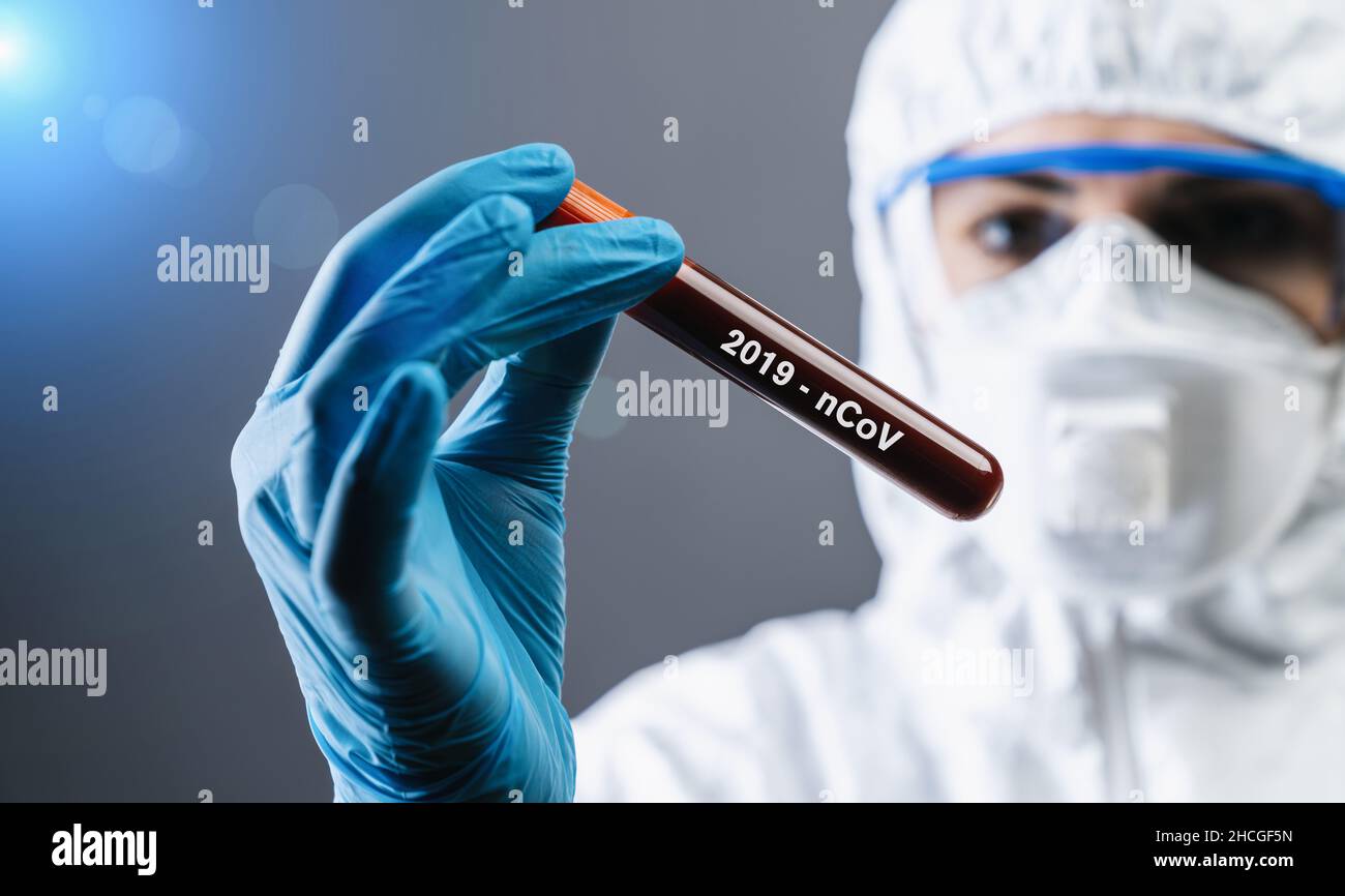 Coronavirus COVID 19 nCov focolaio medico o scientifico tenuta Corona Virus sangue provetta da paziente. Caso positivo di Korona Virus Europe, Ita Foto Stock