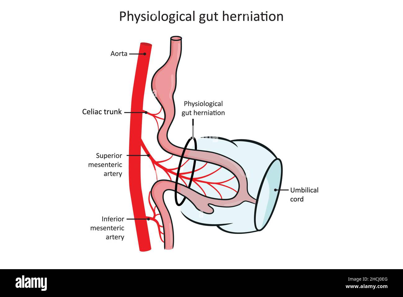 Fisiologica erniazione intestinale, sviluppo del tratto gastrointestinale (alimentare). Foto Stock