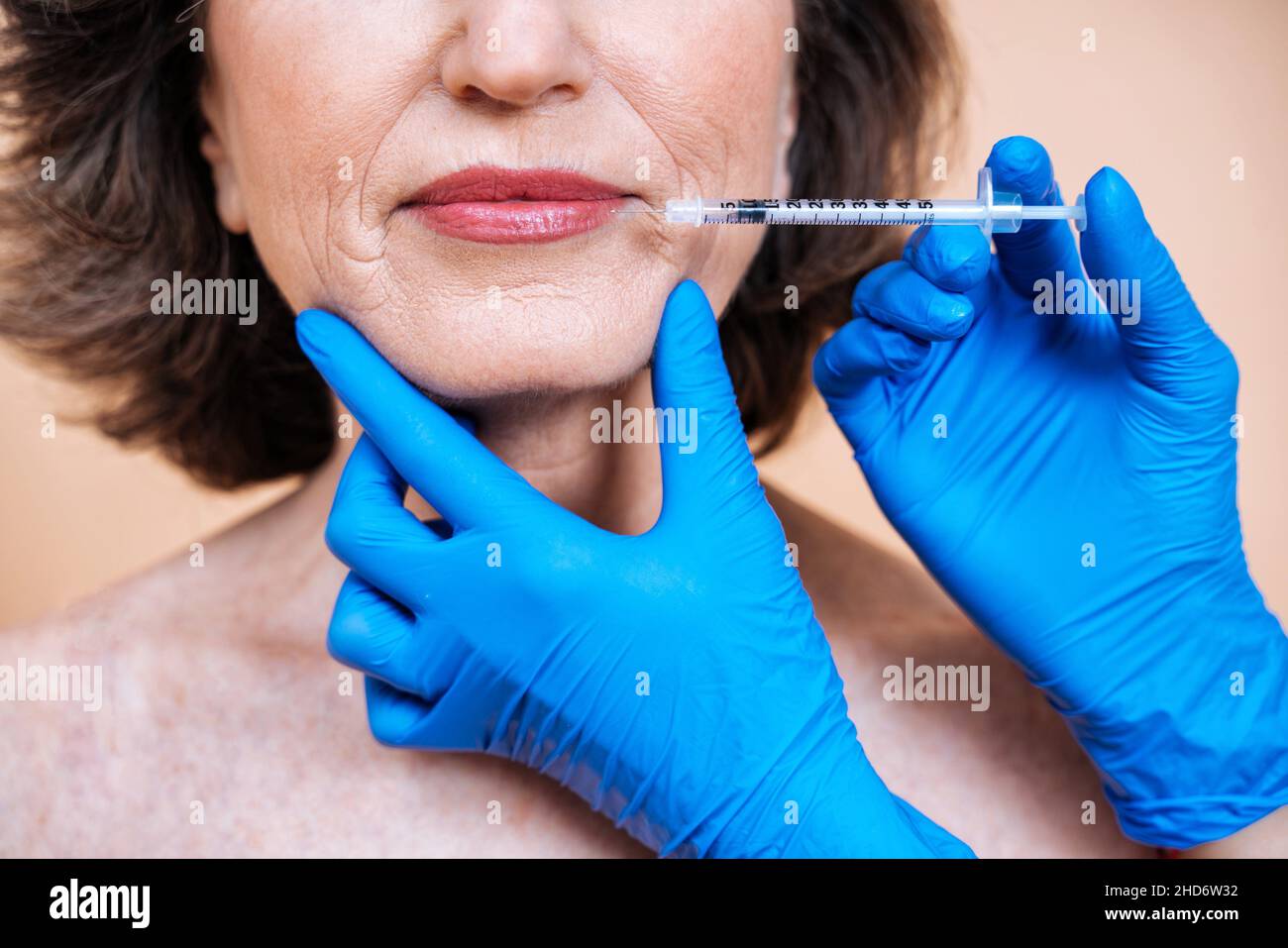 Immagine di una donna anziana che ottiene un trattamento di bellezza. Cliente di un salone di bellezza che prende un'iniezione di riempitivo nel viso contro le rughe e colpi di invecchiamento. Foto Stock