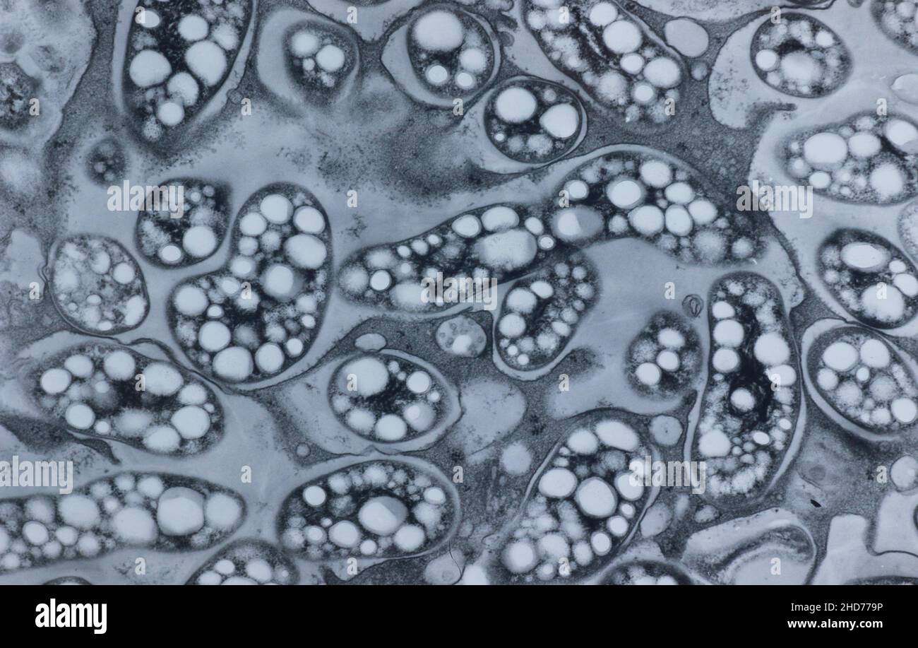 Cellula vegetale al microscopio immagini e fotografie stock ad alta  risoluzione - Alamy