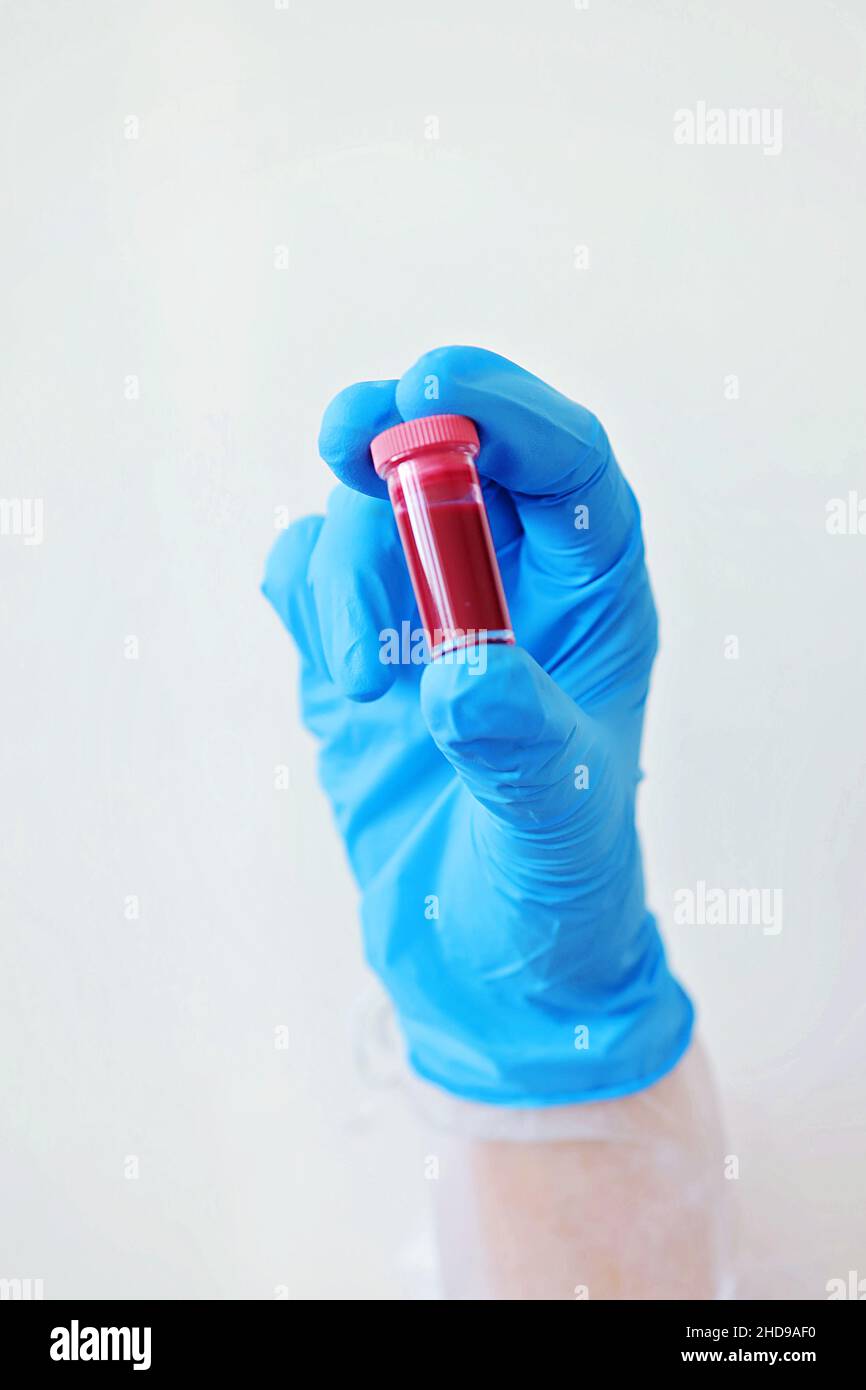 Il medico tiene la provetta con il campione di sangue per l'analisi. Informazioni sull'analisi del sangue. Provetta con il sangue per l'analisi del covid-19. Foto Stock