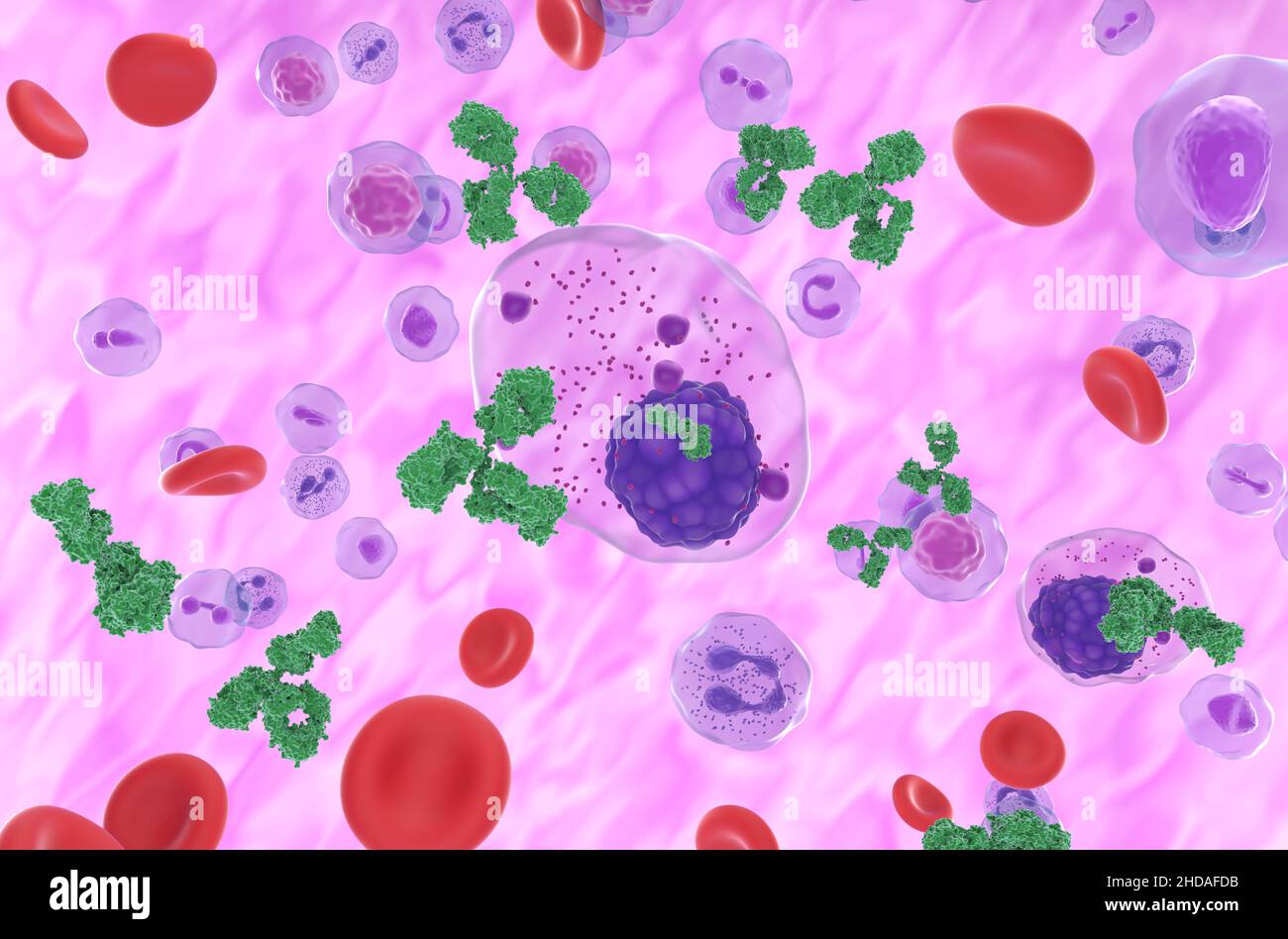 Cellule di mieloma multiplo che emettono proteina M (monoclonale) nel flusso sanguigno - vista isometrica 3D illustrazione Foto Stock