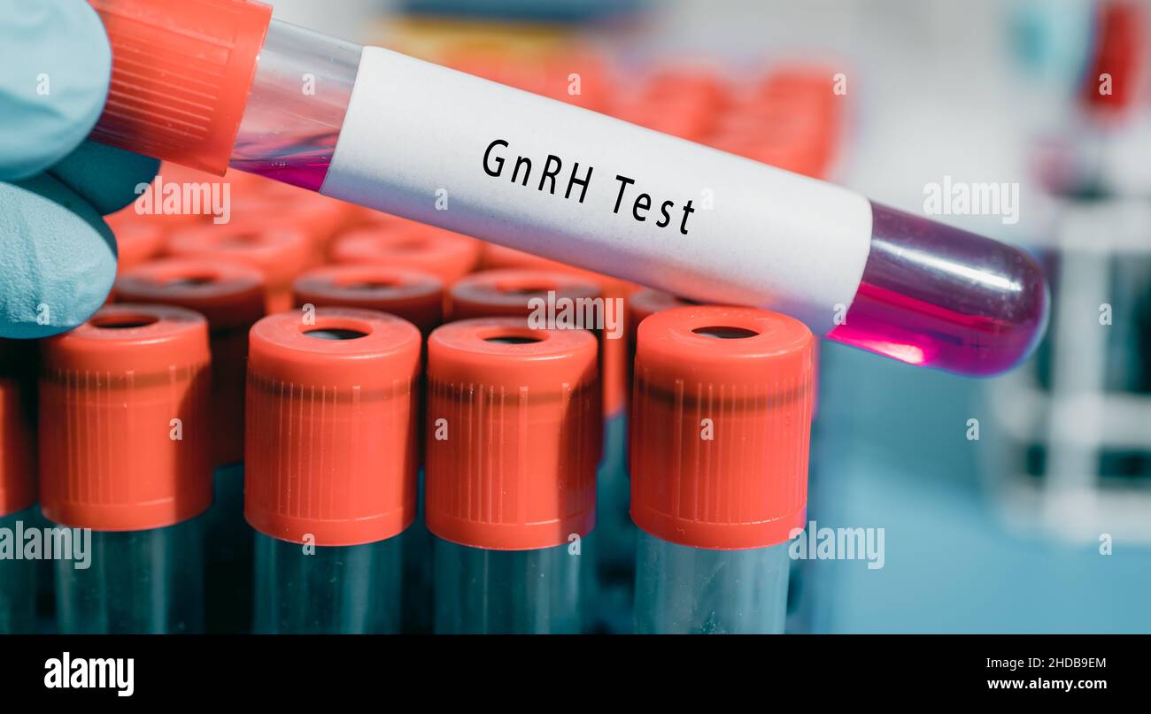 Il test GnRH dell'ormone di rilascio dell'ipotalamo Gonadotropina regola la produzione di LH/FSH nella ghiandola pituitaria Foto Stock