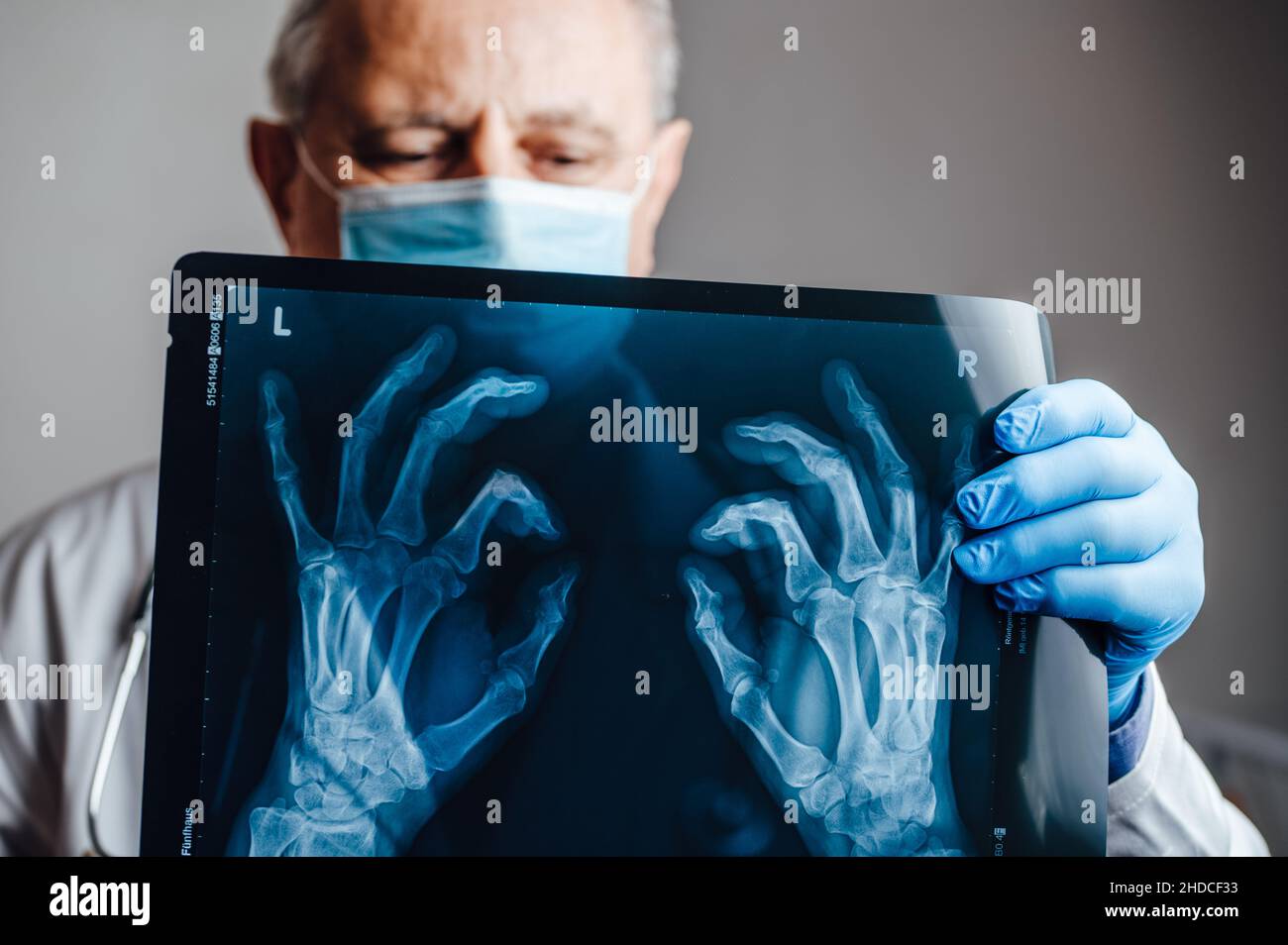 Medico che esamina una radiografia delle ossa delle mani di un paziente Foto Stock