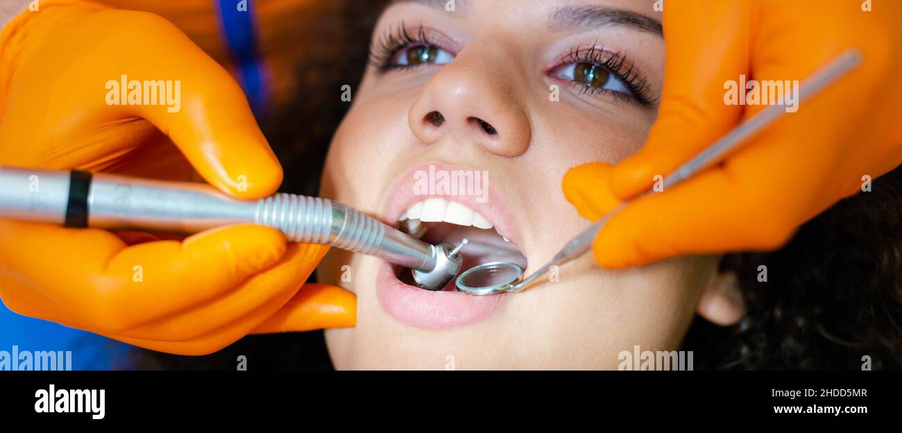 Bella ragazza teenage mista-corsa che ha procedura di perforazione del dente all'ufficio dentale. Mani in guanti di protezione arancioni che tengono gli strumenti. Foto Stock