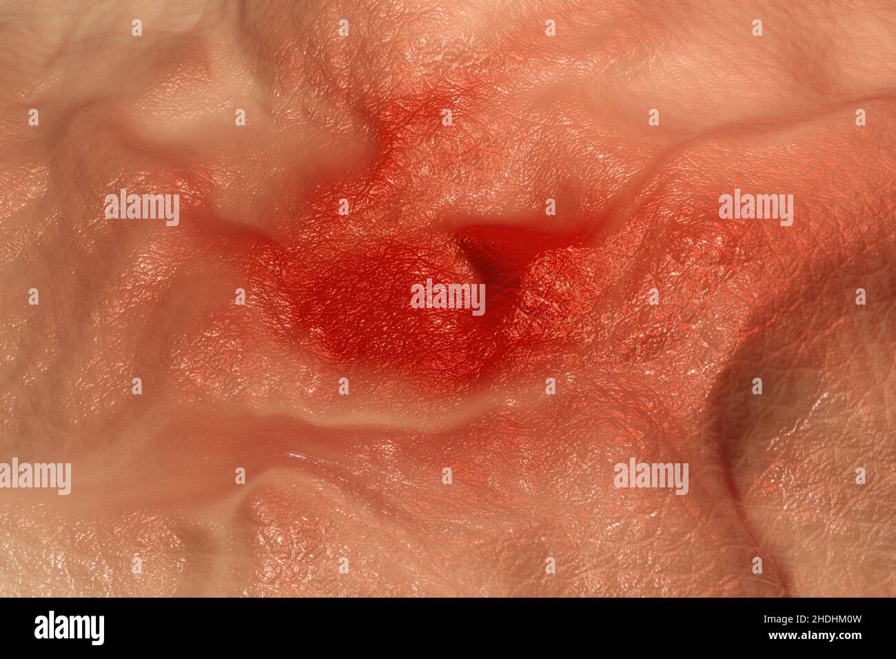 pelle, dermatologia, infiammazione, pelle, dermatologie, infiammazioni Foto Stock