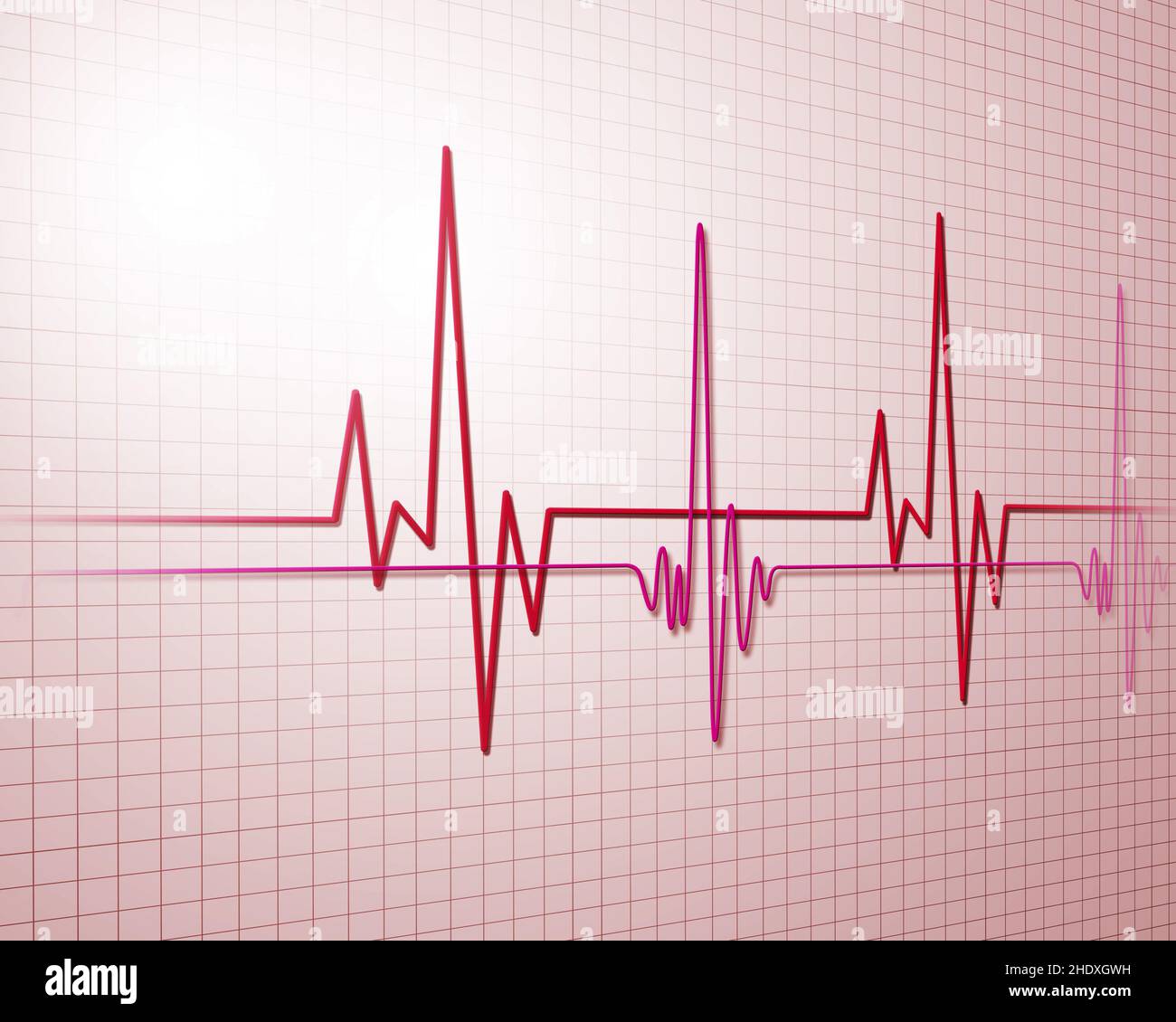 battito cardiaco, ecg, cardiologia, battiti cardiaci, ekg, frequenza cardiaca, cardiologie Foto Stock