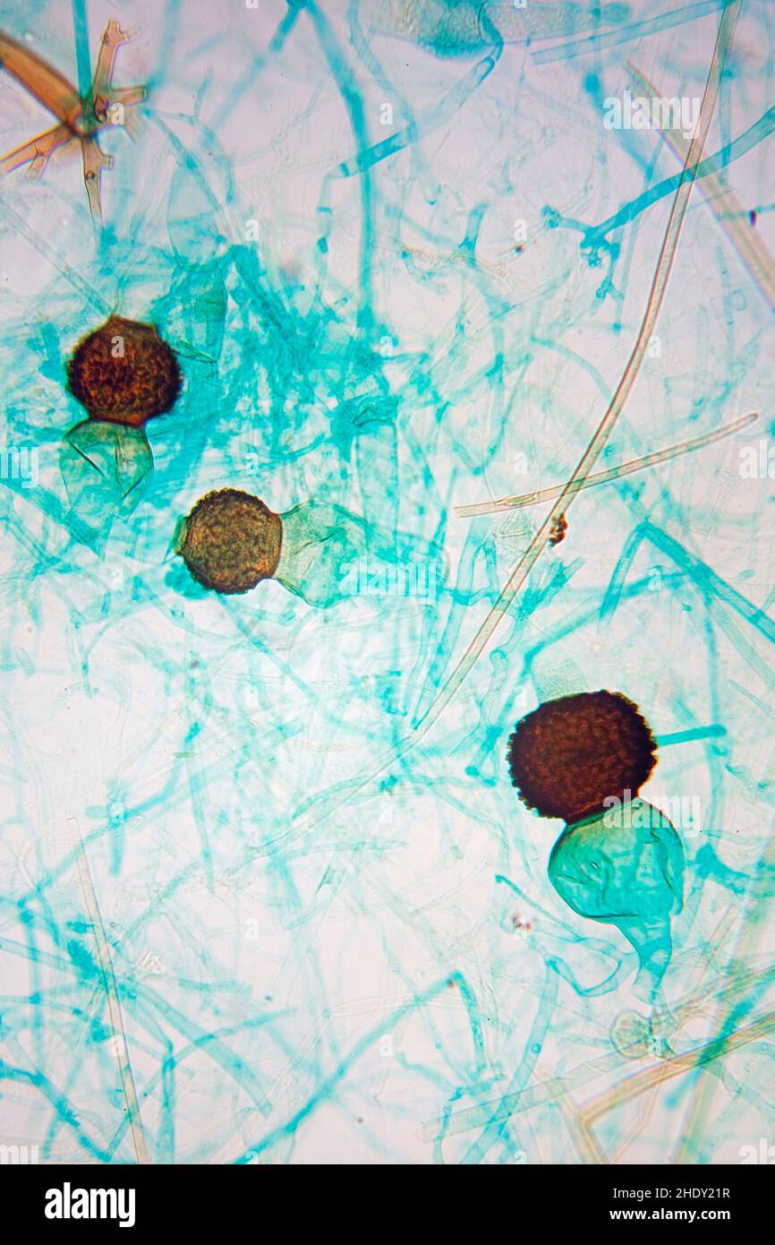 Rhizopus zygotes su vetrino da microscopio a 160x. Foto Stock
