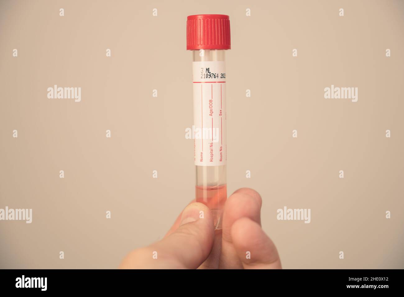 Provetta con vaccino contro coronavirus, 2019-nCoV, SARS-nCov, COVID-19. Foto Stock