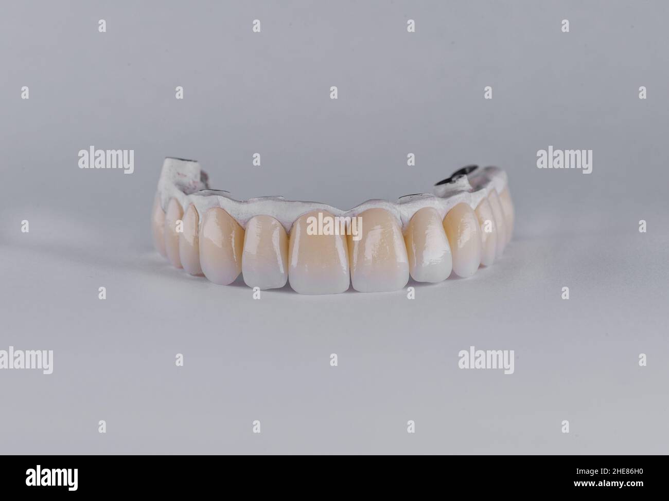 Set di denti in ceramica su sfondo bianco Foto Stock