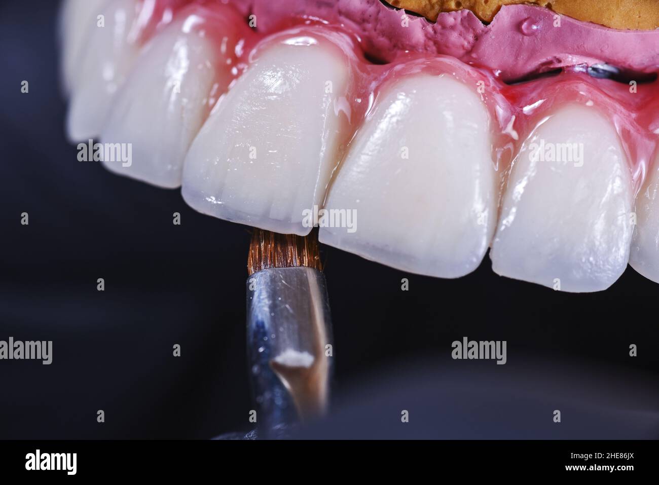 Set di denti in ceramica puliti con una spazzola su sfondo nero Foto Stock
