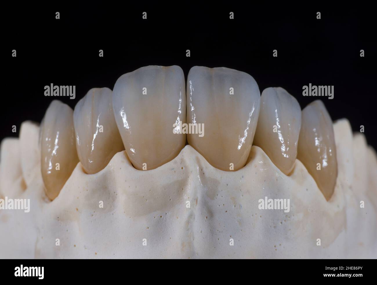 Scatto ad angolo basso di una serie di denti in ceramica su sfondo nero Foto Stock
