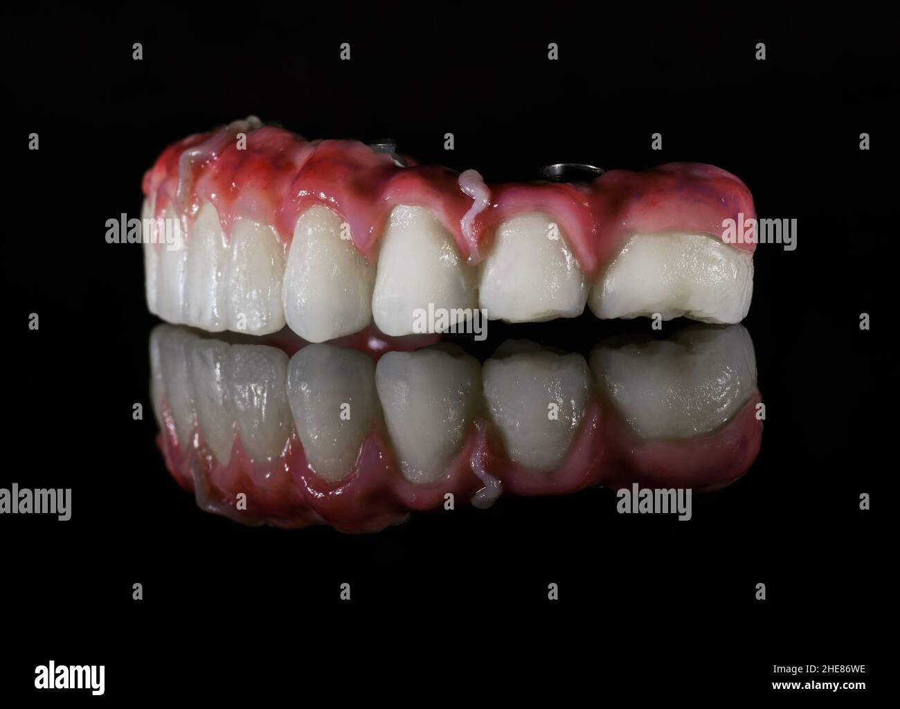 Set di denti in ceramica su sfondo nero Foto Stock