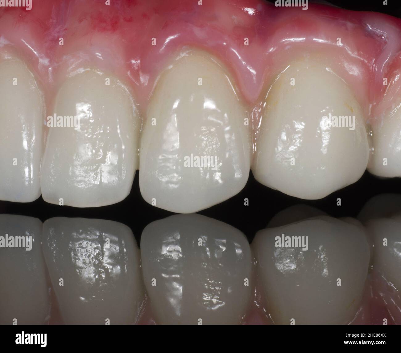 Primo piano di una serie di denti in ceramica su sfondo nero Foto Stock