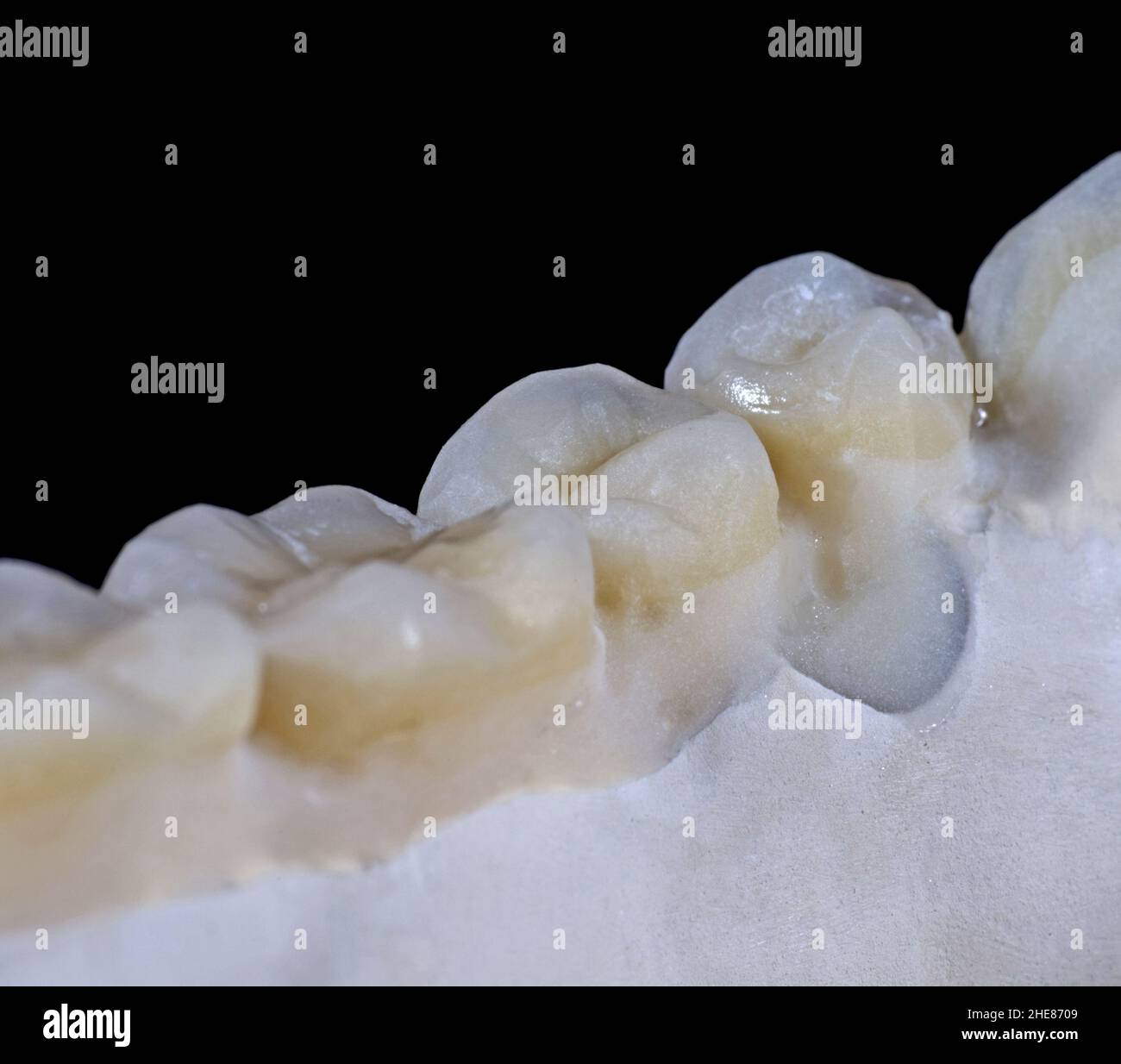 Macro scatto di denti in ceramica su sfondo nero Foto Stock