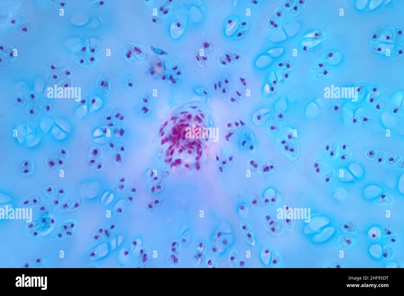 Osso cartilagine ialina umana, micrografia leggera Foto Stock