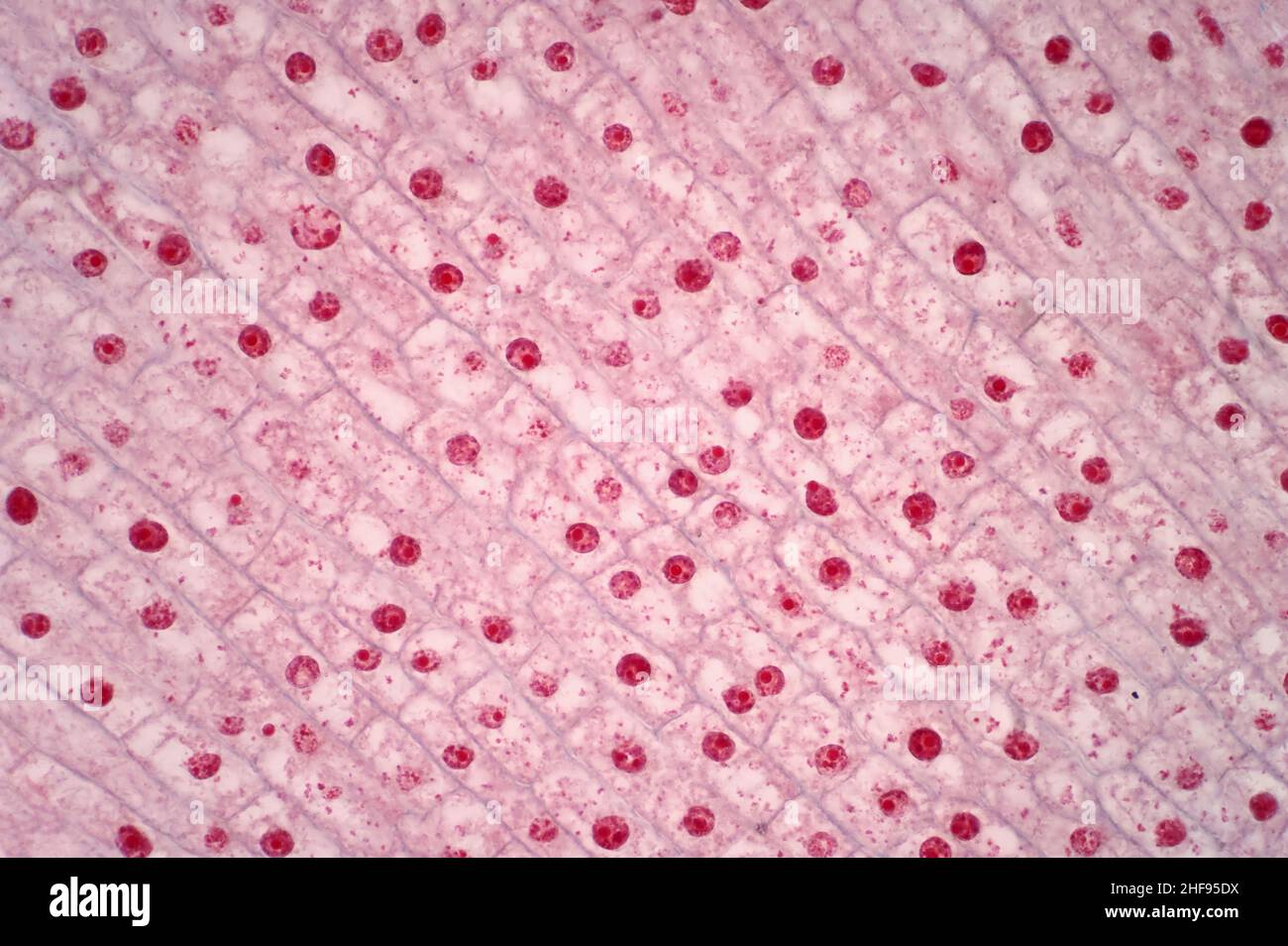 La mitosi, micrografia di luce Foto Stock