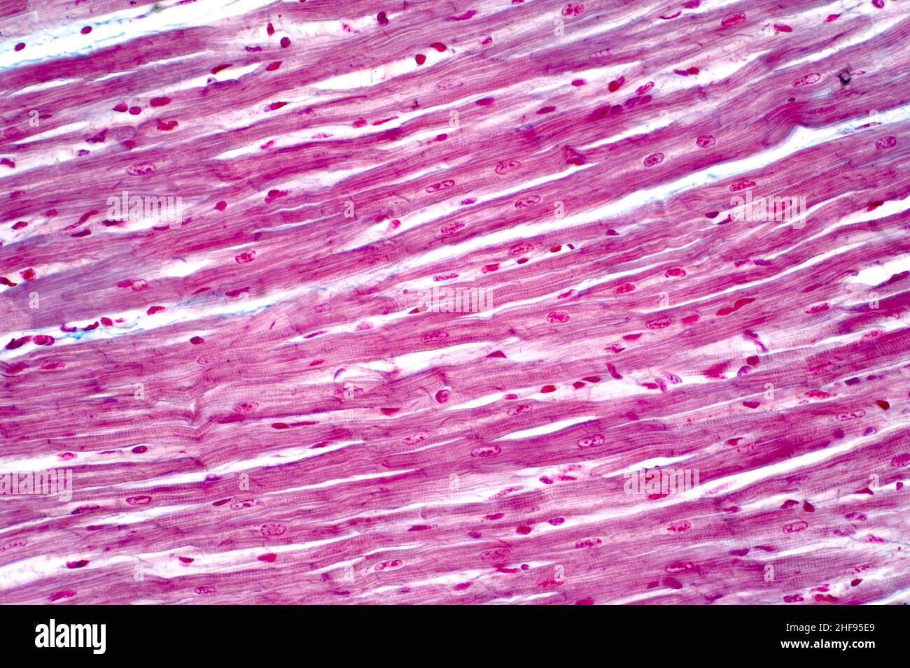 Muscolo cardiaco, micrografia leggera Foto Stock
