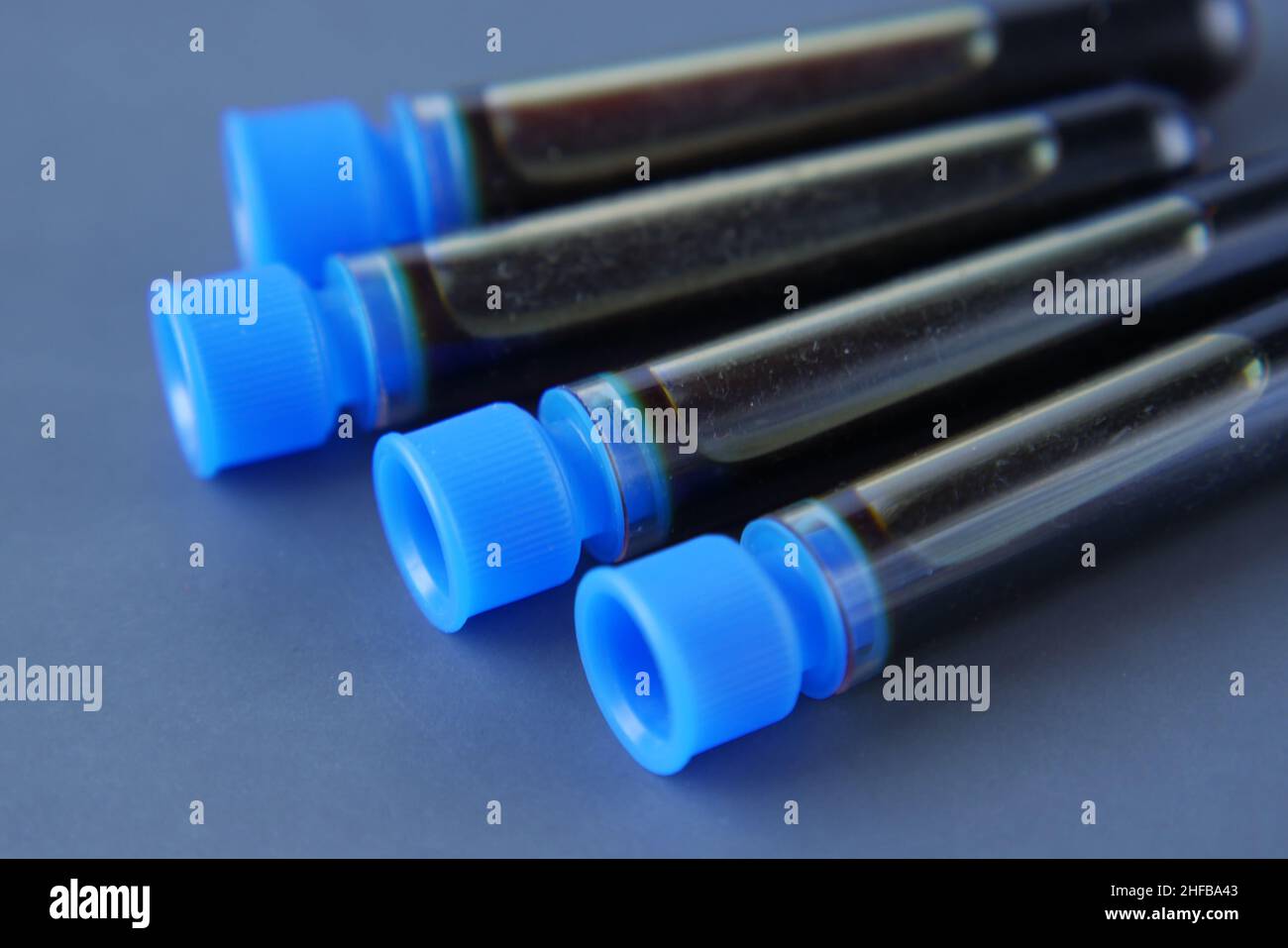 primo piano della provetta per analisi del sangue sul tavolo Foto Stock