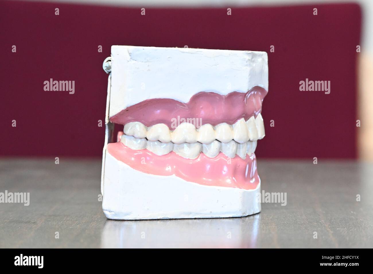 Vista laterale del modello dentale Foto Stock