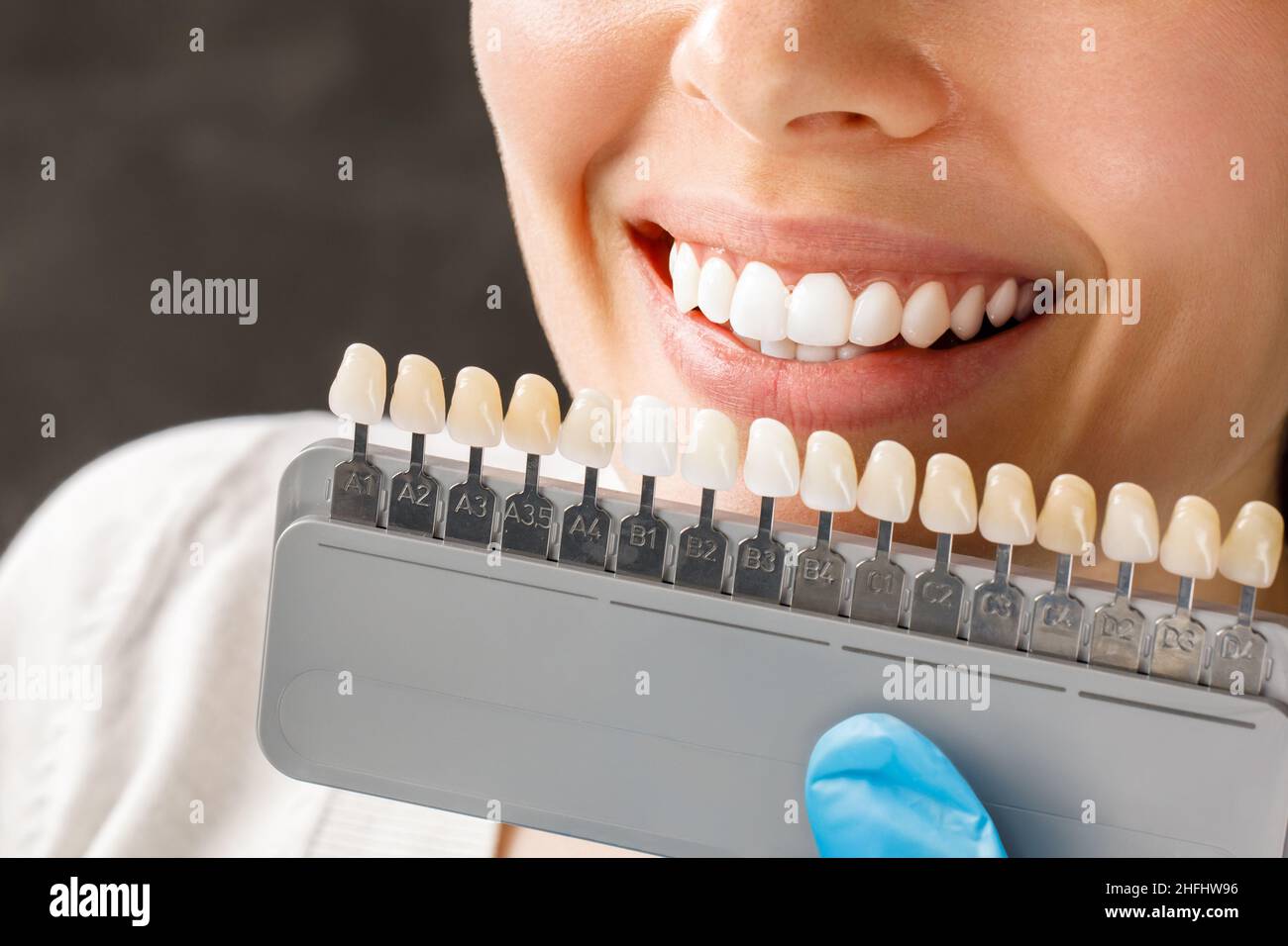Giovane donna sorridente. Denti cosmetologici sbiancanti in una clinica odontoiatrica selezione del tono del dente dell'impianto Foto Stock