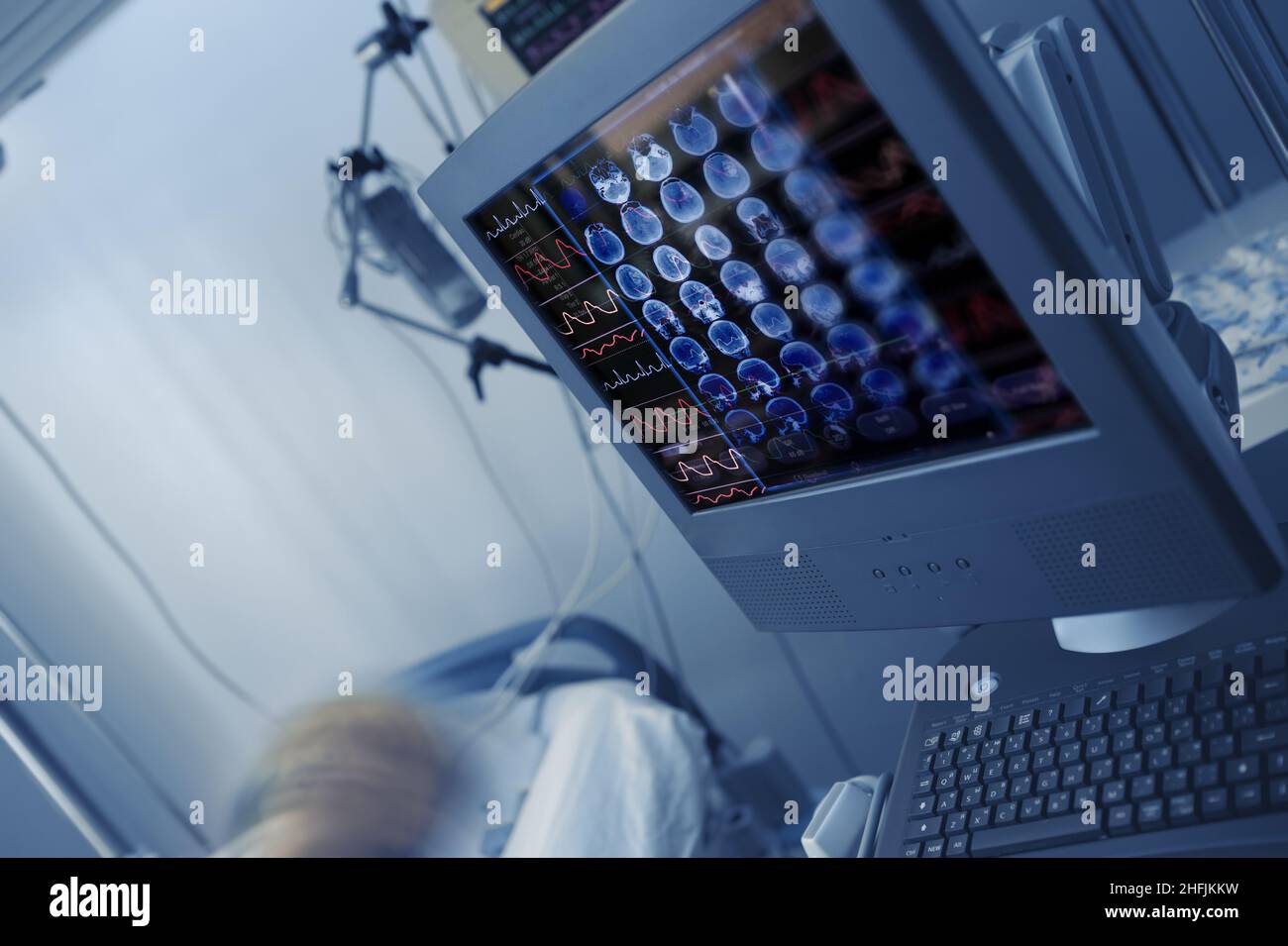 Immagini degli studi ECG e TC sul monitor del computer della struttura ospedaliera al posto letto del paziente. Foto Stock