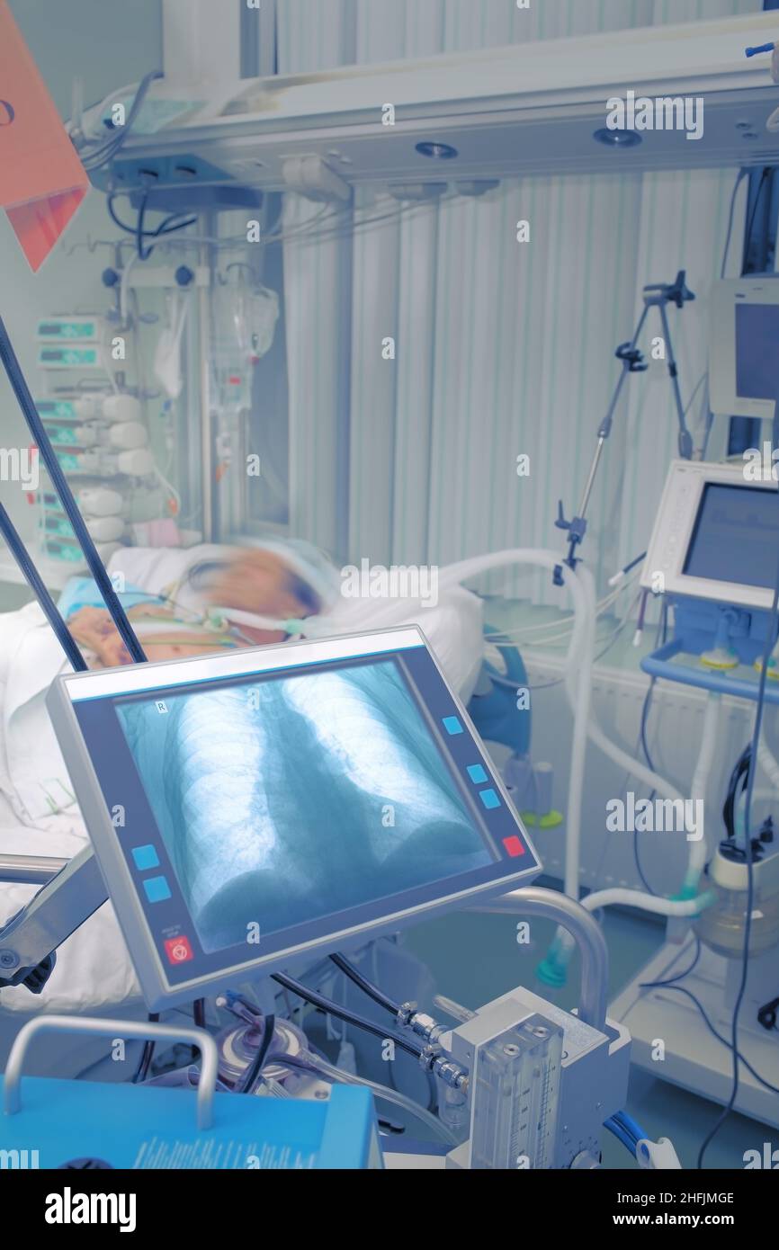 Studio radiologico del torace del paziente sul display del computer medico nel reparto ospedaliero. Concetto di tecnologie sofisticate nella scienza medica. Foto Stock